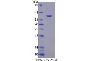 Image no. 1 for Peroxisomal Biogenesis Factor 19 (PEX19) (AA 2-296) protein (His tag) (ABIN5665360)