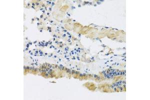 Immunohistochemistry of paraffin-embedded mouse lung using CLIP1 antibody. (CLIP1 anticorps  (AA 1228-1427))