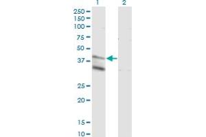 Western Blot analysis of LASS4 expression in transfected 293T cell line by LASS4 monoclonal antibody (M03), clone 7D5.