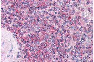 Human Spleen: Formalin-Fixed, Paraffin-Embedded (FFPE)