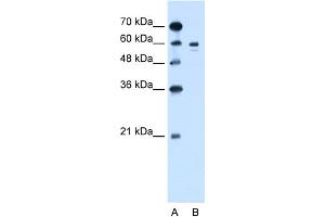 WB Suggested Anti-TYR Antibody Titration:  1. (TYR anticorps  (Middle Region))