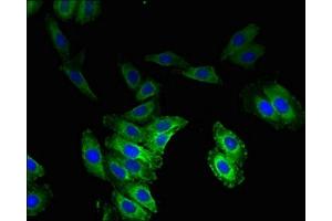Immunofluorescent analysis of HepG2 cells using ABIN7175503 at dilution of 1:100 and Alexa Fluor 488-congugated AffiniPure Goat Anti-Rabbit IgG(H+L)