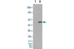 HEK293 overexpressing ALDH1A1 and probed with ALDH1A1 polyclonal antibody  (mock transfection in first lane), tested by Origene. (ALDH1A1 anticorps  (C-Term))