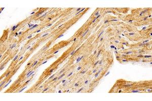 Detection of BMP2 in Rat Cardiac Muscle Tissue using Polyclonal Antibody to Bone Morphogenetic Protein 2 (BMP2)