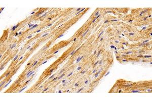 Detection of BMP2 in Rat Cardiac Muscle Tissue using Polyclonal Antibody to Bone Morphogenetic Protein 2 (BMP2) (BMP2 anticorps  (AA 49-243))