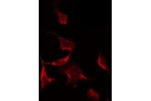 ABIN6268845 staining NIH-3T3 by IF/ICC. (NRF1 anticorps  (Internal Region))