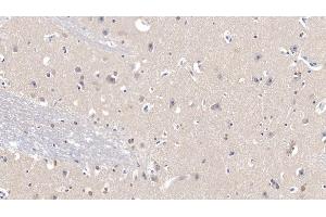 Detection of SOD1 in Human Cerebrum Tissue using Polyclonal Antibody to Superoxide Dismutase 1 (SOD1) (SOD1 anticorps  (AA 2-154))