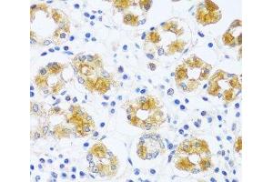 Immunohistochemistry of paraffin-embedded Human stomach using BRK1 Polyclonal Antibody at dilution of 1:100 (40x lens).