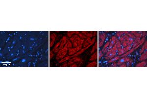 Rabbit Anti-ADH1B Antibody   Formalin Fixed Paraffin Embedded Tissue: Human heart Tissue Observed Staining: Cytoplasmic Primary Antibody Concentration: N/A Other Working Concentrations: 1:600 Secondary Antibody: Donkey anti-Rabbit-Cy3 Secondary Antibody Concentration: 1:200 Magnification: 20X Exposure Time: 0. (ADH1B anticorps  (N-Term))