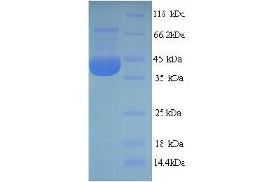 SDS-PAGE (SDS) image for NADPH Oxidase 4 (NOX4) (AA 210-424), (Extracellular) protein (His-SUMO Tag) (ABIN5713704)