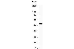 Western blot testing of alpha Catenin antibody and recombinant human protein (0. (CTNNA1 anticorps  (AA 143-292))