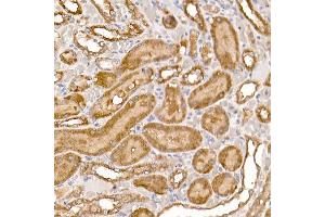 Immunohistochemistry of paraffin-embedded rat kidney using NUMB Rabbit pAb (ABIN6129424, ABIN6144943, ABIN6144944 and ABIN6224990) at dilution of 1:250 (40x lens).
