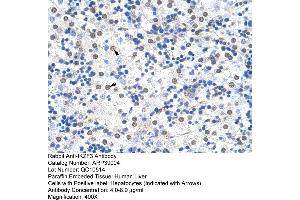 Human Liver (IKZF3 anticorps  (N-Term))