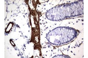 Image no. 2 for anti-Tuberous Sclerosis 1 (TSC1) (AA 836-1164) antibody (ABIN1491685) (TSC1 anticorps  (AA 836-1164))
