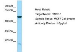 Image no. 1 for anti-RAB7, Member RAS Oncogene Family-Like 1 (RAB7L1) (N-Term) antibody (ABIN6750021) (RAB7L1 anticorps  (N-Term))