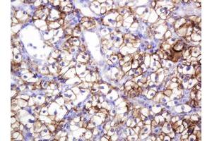 Image no. 5 for anti-Carbonic Anhydrase 12 (CA12) antibody (ABIN1497068)