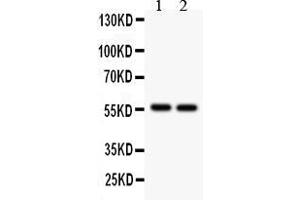 Anti- ALDH2  Picoband antibody, Western blottingAll lanes: Anti ALDH2  at 0.
