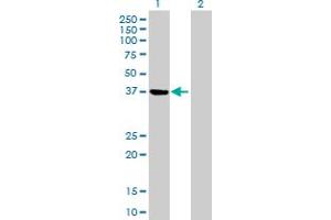 Western Blot analysis of PSAT1 expression in transfected 293T cell line by PSAT1 MaxPab polyclonal antibody. (PSAT1 anticorps  (AA 1-370))