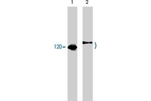 Western blot analysis of human Jurkat cells untreated (lane 1) or treated with pervanadate (1 mM) for 30 minutes (lane 2). (CBL anticorps  (C-Term))