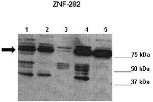 Lanes : Lane 1: 20ug Bewo cells Lane 2: 20ug HEK cells Lane 3: 20ug JEG3 cells Lane 4: 20ug PC3 cells Lane 5: 20ug SHEP cells  Primary Antibody Dilution :  1:1000   Secondary Antibody : Anti-rabbit-HRP  Secondary Antibody Dilution :  1:7500  Gene Name : ZNF282  Submitted by : Lisa Stubbs, University of Illinois (ZNF282 anticorps  (C-Term))