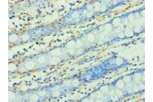Immunohistochemistry of paraffin-embedded human colon tissue using ABIN7166295 at dilution of 1:100 (WNT2 anticorps  (AA 26-360))