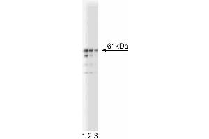 Western blot analysis of Beclin on a Jurkat lysate. (Beclin 1 anticorps  (AA 171-291))