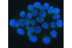 IF analysis of SEC24C using anti-SEC24C antibody (ABIN7600303).