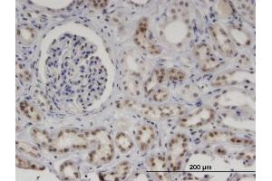 Immunoperoxidase of monoclonal antibody to MNDA on formalin-fixed paraffin-embedded human kidney. (MNDA anticorps  (AA 311-407))