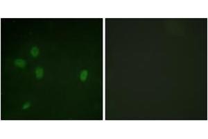 Immunofluorescence analysis of NIH-3T3 cells, using 53BP1 (Phospho-Ser25) Antibody. (TP53BP1 anticorps  (pSer25))