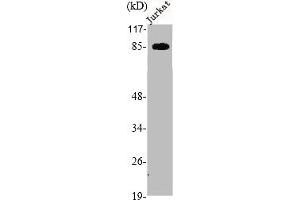 Western Blot analysis of Jurkat cells using cGKII Polyclonal Antibody