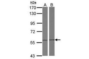 Image no. 1 for anti-Chaperonin Containing TCP1, Subunit 4 (Delta) (CCT4) (AA 79-378) antibody (ABIN1497138) (CCT4 anticorps  (AA 79-378))