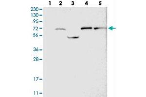 Western blot analysis of Lane 1: RT-4, Lane 2: U-251 MG, Lane 3: Human Plasma, Lane 4: Liver, Lane 5: Tonsil with GUCY1B3 polyclonal antibody  at 1:250-1:500 dilution. (GUCY1B3 anticorps)