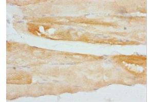 Immunohistochemistry of paraffin-embedded human skeletal muscle tissue using ABIN7149013 at dilution of 1:100