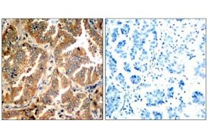 Image no. 1 for anti-Adducin 1 (Alpha) (ADD1) (Ser726) antibody (ABIN197406)