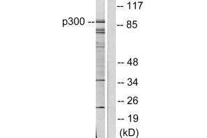 Western blot analysis of extracts from COLO205 cells, using P300/CBP antibody. (EP3/CREBBP anticorps)