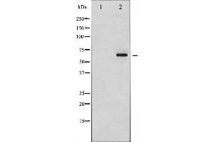 Western blot analysis of Smad1 phosphorylation expression in Serum treated HeLa whole cell lysates,The lane on the left is treated with the antigen-specific peptide.