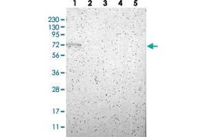 Western blot analysis of Lane 1: RT-4, Lane 2: U-251 MG, Lane 3: Human Plasma, Lane 4: Liver, Lane 5: Tonsil with RBM47 polyclonal antibody  at 1:250-1:500 dilution. (RBM47 anticorps)