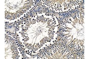 ABIN6259328 and ABIN6275301 at 1/100 staining rat testis tissue by IHC-P. (NBPF7 anticorps  (C-Term))