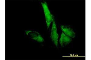 Immunofluorescence of purified MaxPab antibody to EIF3S5 on HeLa cell.