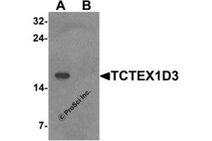 Western Blotting (WB) image for anti-T-Complex-Associated-Testis-Expressed 3 (TCTE3) (N-Term) antibody (ABIN1587949) (TCTE3 anticorps  (N-Term))