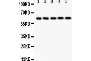 Western Blotting (WB) image for anti-SHC (Src Homology 2 Domain Containing) Transforming Protein 1 (SHC1) (AA 536-564), (C-Term) antibody (ABIN3043923)
