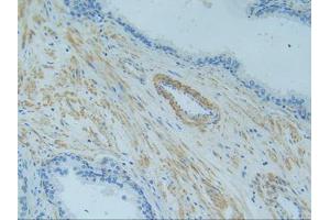 IHC-P analysis of Human Prostate Gland Tissue, with DAB staining. (TNFRSF1A anticorps  (AA 60-236))