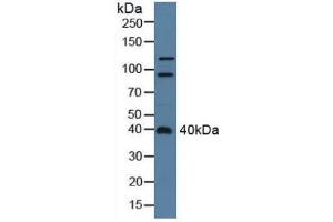 Western blot analysis of Rat Serum. (ADAP2 anticorps  (AA 49-360))