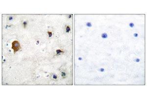 Immunohistochemistry (IHC) image for anti-Gap Junction Protein, alpha 1, 43kDa (GJA1) (C-Term) antibody (ABIN1848481) (Connexin 43/GJA1 anticorps  (C-Term))