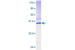 Signal Sequence Receptor, delta (SSR4) (AA 24-173) protein (GST tag)