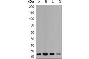 Western blot analysis of mPR expression in HepG2 (A), SW480 (B), mouse liver (C), mouse brain (D) whole cell lysates. (mPR anticorps)