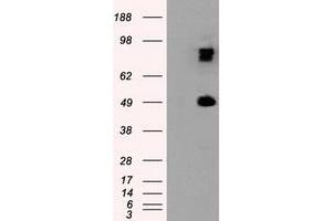 Western Blotting (WB) image for anti-Proteasome (Prosome, Macropain) 26S Subunit, ATPase, 3 (PSMC3) antibody (ABIN1501328) (PSMC3 anticorps)