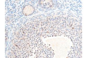 ABIN6267250 at 1/100 staining rat ovarian tissue sections by IHC-P.