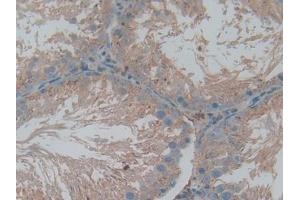DAB staining on IHC-P; Samples: Rat Testis Tissue (Cathepsin L anticorps  (AA 114-288))