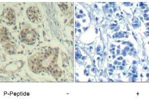 Image no. 1 for anti-Mdm2, p53 E3 Ubiquitin Protein Ligase Homolog (Mouse) (MDM2) (pSer166) antibody (ABIN401610) (MDM2 anticorps  (pSer166))